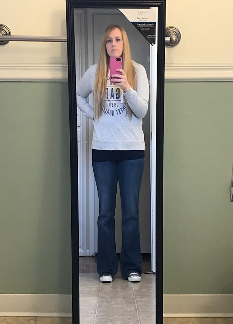 Patients 20-39 Years Old Before & After Gallery - Patient 14494311 - Image 2