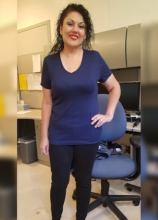 Patients 20-39 Years Old Before & After Gallery - Patient 14494313 - Image 2