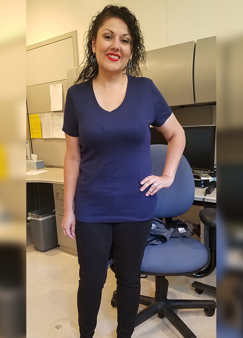 Patients 20-39 Years Old Before & After Gallery - Patient 14494313 - Image 2