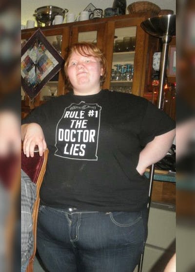 Patients 20-39 Years Old Before & After Gallery - Patient 14494314 - Image 1