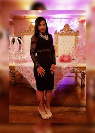 Patients 20-39 Years Old Before & After Gallery - Patient 14494318 - Image 2