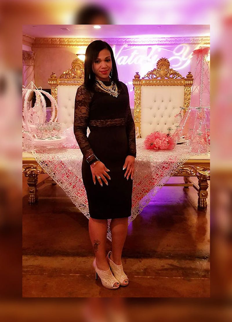 Patients 20-39 Years Old Before & After Gallery - Patient 14494318 - Image 2