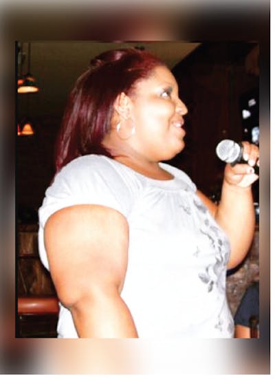 Patients 20-39 Years Old Before & After Gallery - Patient 14494320 - Image 1