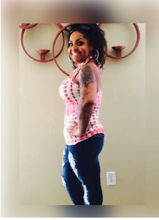 Patients 20-39 Years Old Before & After Gallery - Patient 14494320 - Image 2