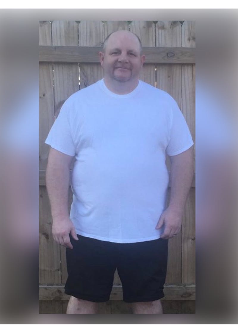 Patients 20-39 Years Old Before & After Gallery - Patient 14494321 - Image 1