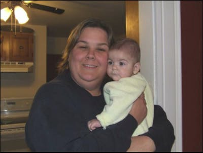 Patients 20-39 Years Old Before & After Gallery - Patient 14494323 - Image 1