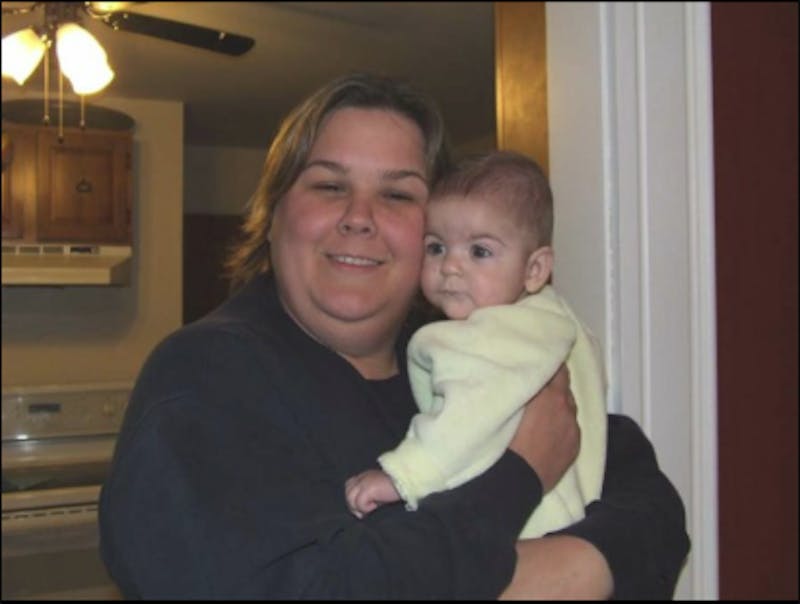 Patients 20-39 Years Old Before & After Gallery - Patient 14494323 - Image 1