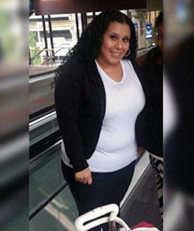 Patients 20-39 Years Old Before & After Gallery - Patient 14494327 - Image 1