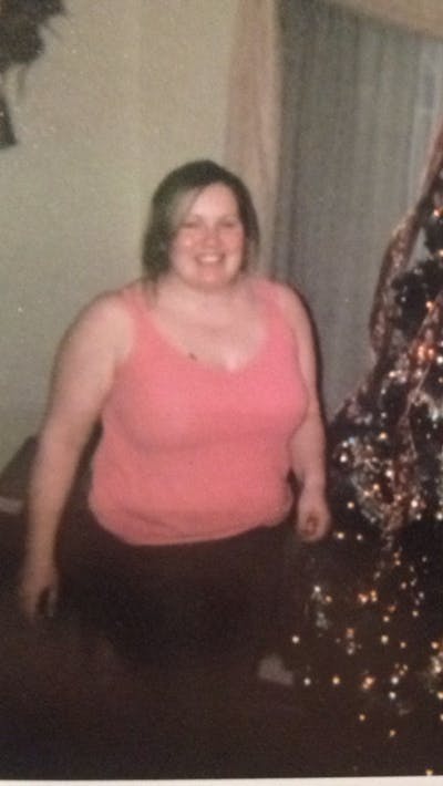 Patients 20-39 Years Old Before & After Gallery - Patient 14494328 - Image 1