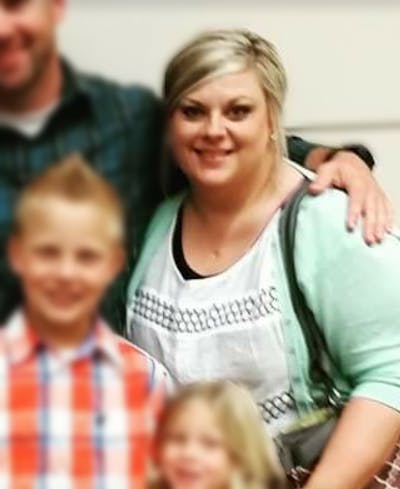 Patients 20-39 Years Old Before & After Gallery - Patient 14494329 - Image 1