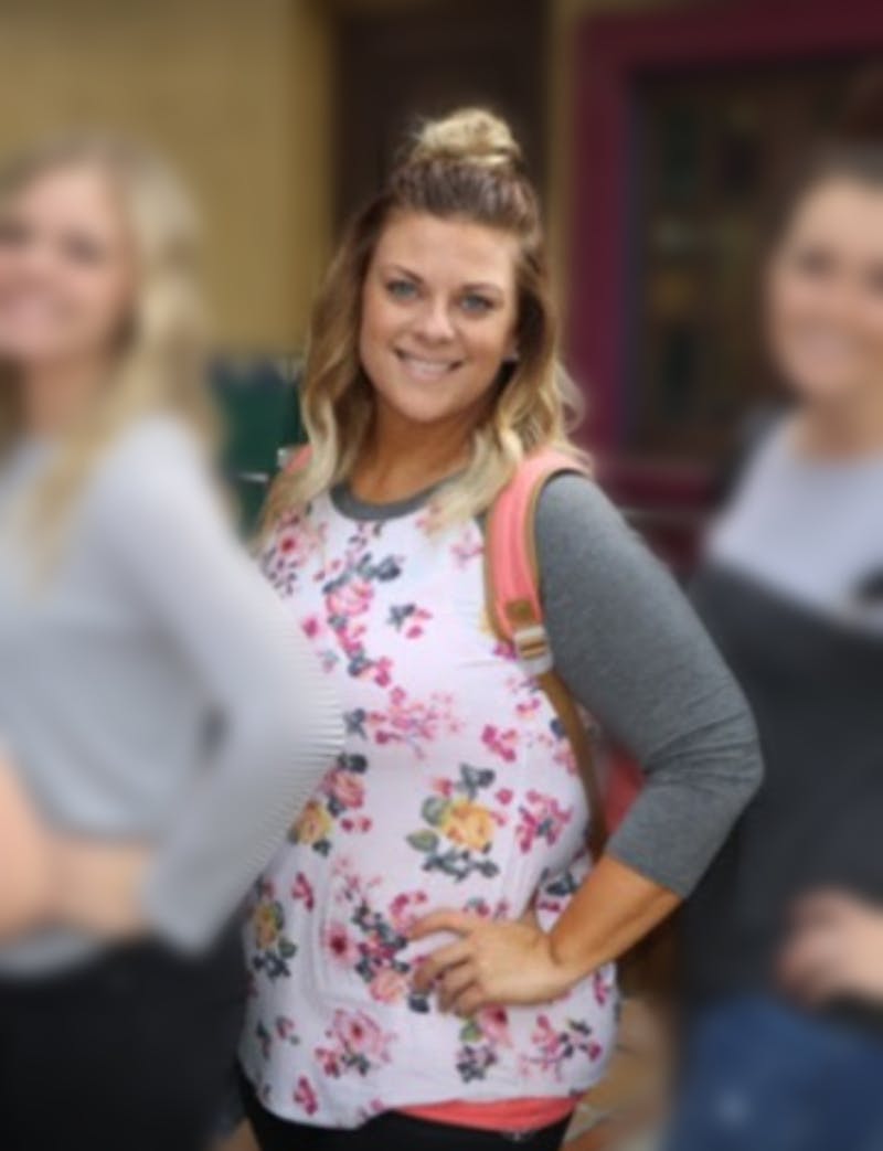 Patients 20-39 Years Old Before & After Gallery - Patient 14494329 - Image 2