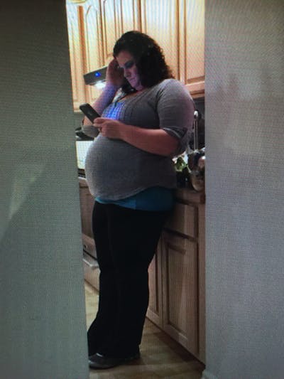 Patients 20-39 Years Old Before & After Gallery - Patient 14494330 - Image 1