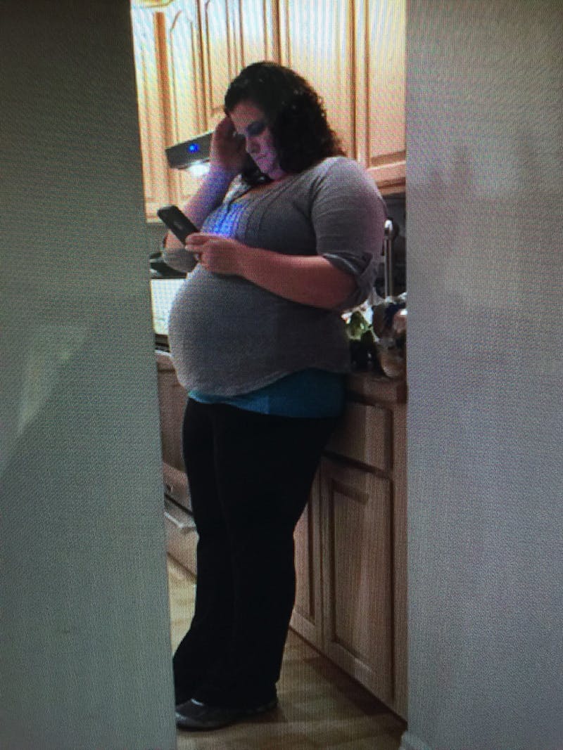 Patients 20-39 Years Old Before & After Gallery - Patient 14494330 - Image 1