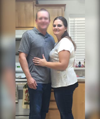 Patients 20-39 Years Old Before & After Gallery - Patient 14494330 - Image 2