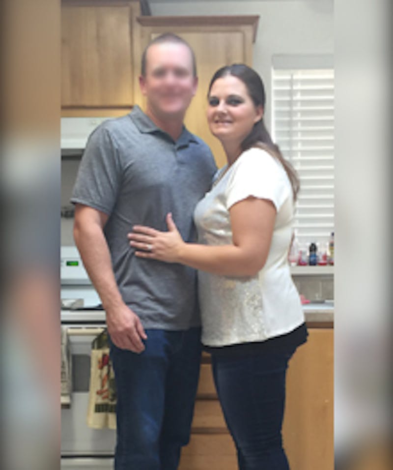 Patients 20-39 Years Old Before & After Gallery - Patient 14494330 - Image 2