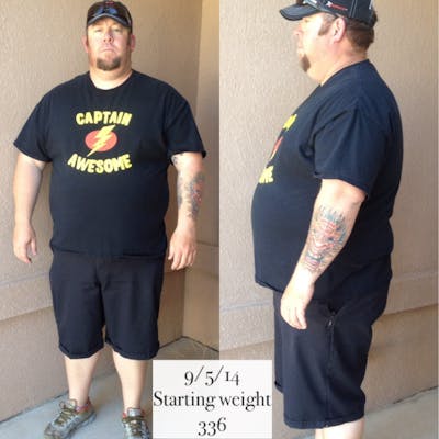 Patients 20-39 Years Old Before & After Gallery - Patient 14494331 - Image 1