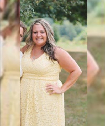 Patients 20-39 Years Old Before & After Gallery - Patient 14494332 - Image 1