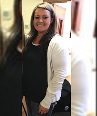 Patients 20-39 Years Old Before & After Gallery - Patient 14494332 - Image 2