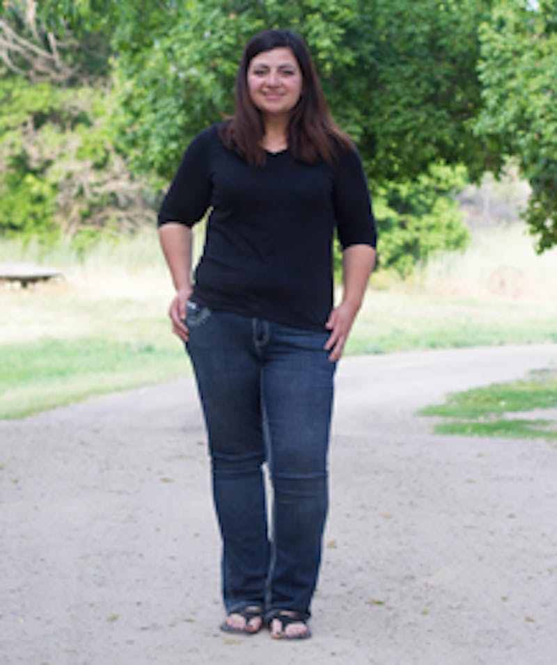 Patients 20-39 Years Old Before & After Gallery - Patient 14494335 - Image 2