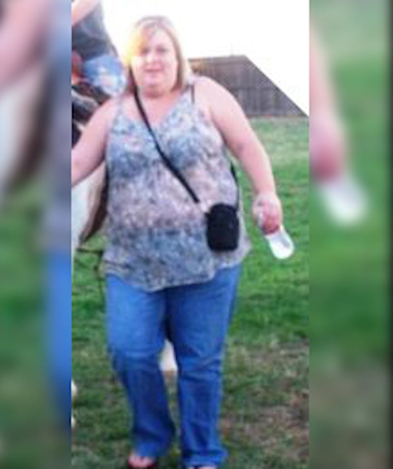 Patients 20-39 Years Old Before & After Gallery - Patient 14494337 - Image 1