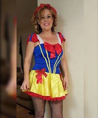 Patients 20-39 Years Old Before & After Gallery - Patient 14494337 - Image 2