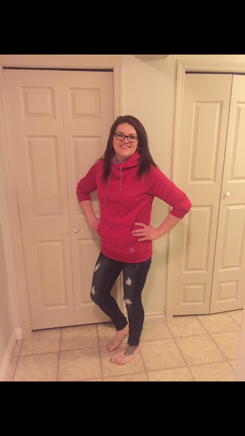 Patients 20-39 Years Old Before & After Gallery - Patient 14494339 - Image 2