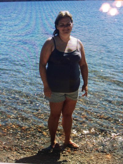 Patients 20-39 Years Old Before & After Gallery - Patient 14494344 - Image 1