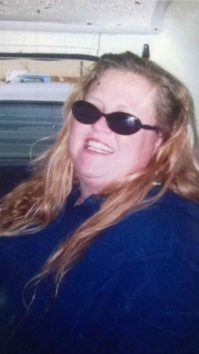 Patients 20-39 Years Old Before & After Gallery - Patient 14494345 - Image 1