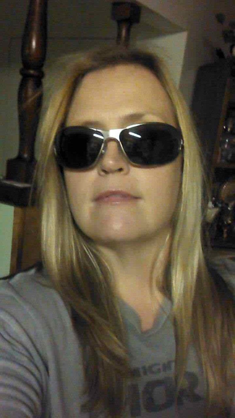 Patients 20-39 Years Old Before & After Gallery - Patient 14494345 - Image 2