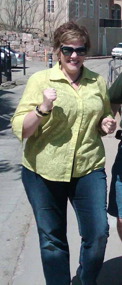 Patients 20-39 Years Old Before & After Gallery - Patient 14494346 - Image 1