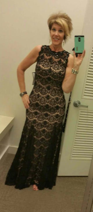 Patients 20-39 Years Old Before & After Gallery - Patient 14494346 - Image 2