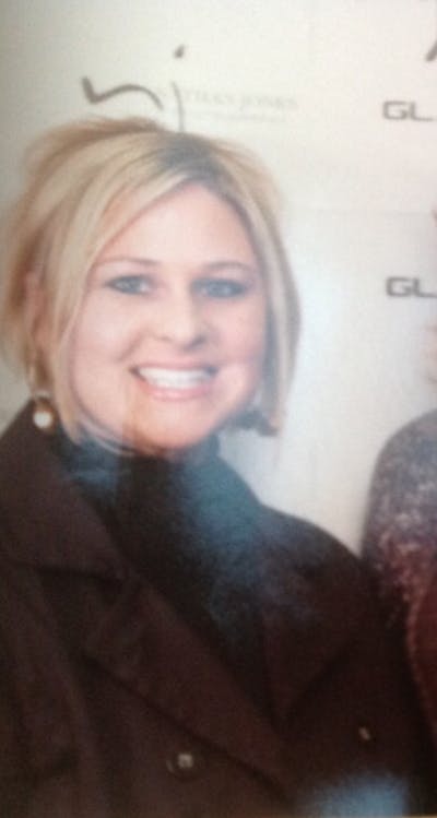 Patients 20-39 Years Old Before & After Gallery - Patient 14494347 - Image 1