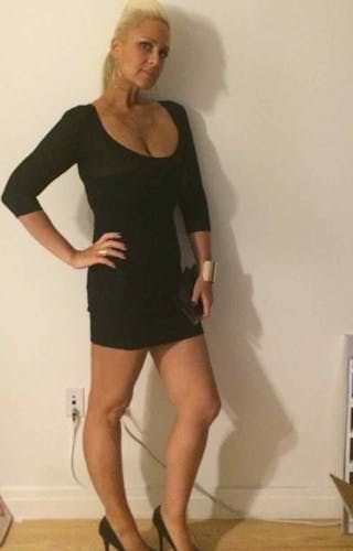 Patients 20-39 Years Old Before & After Gallery - Patient 14494347 - Image 2