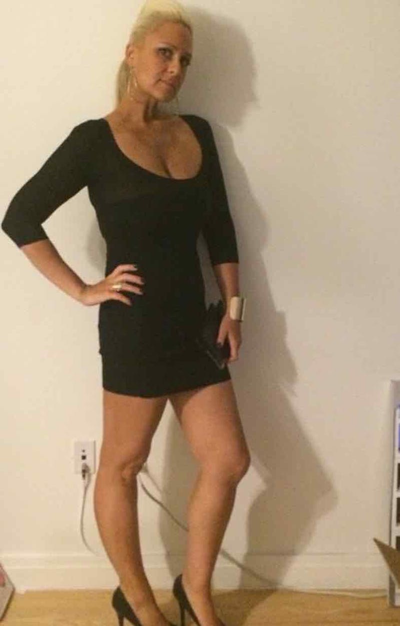 Patients 20-39 Years Old Before & After Gallery - Patient 14494347 - Image 2