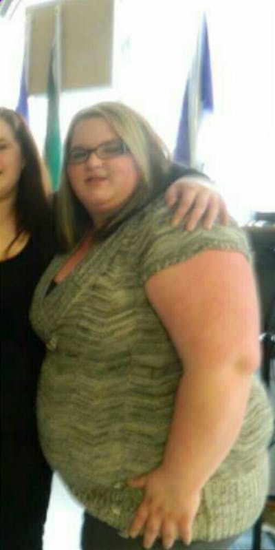 Patients 20-39 Years Old Before & After Gallery - Patient 14494349 - Image 1