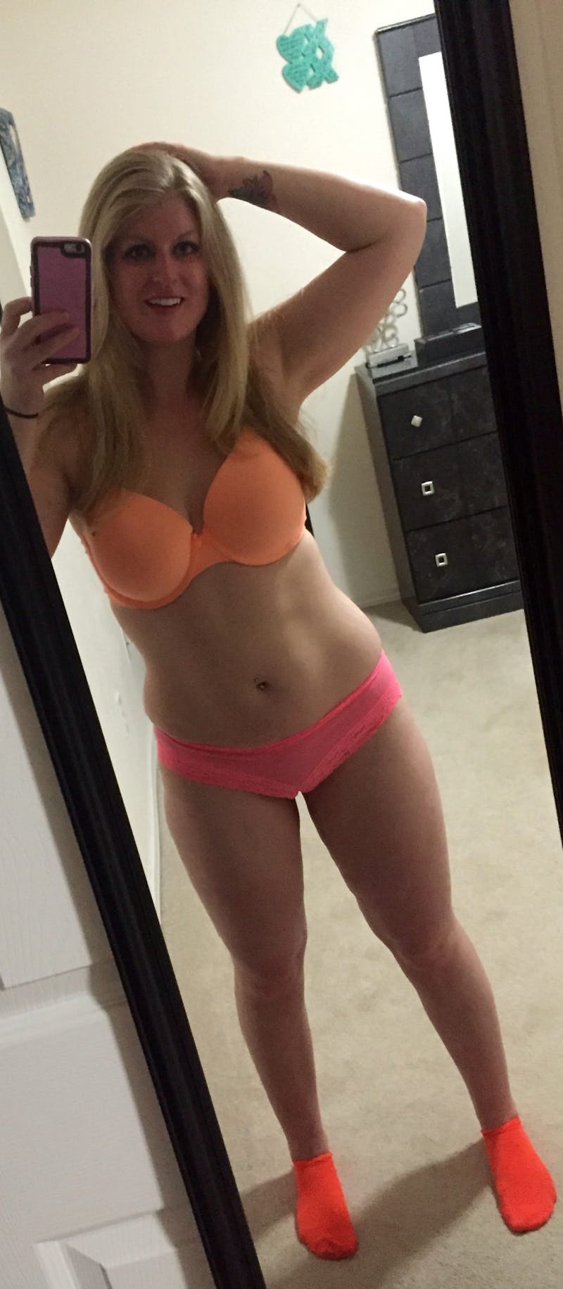 Patients 20-39 Years Old Before & After Gallery - Patient 14494350 - Image 2