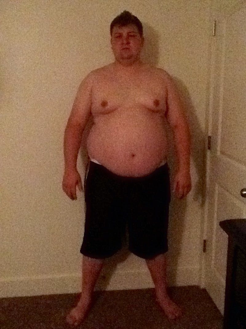 Patients 20-39 Years Old Before & After Gallery - Patient 14494352 - Image 1