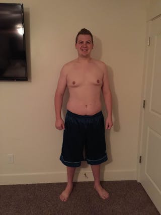 Patients 20-39 Years Old Before & After Gallery - Patient 14494352 - Image 2