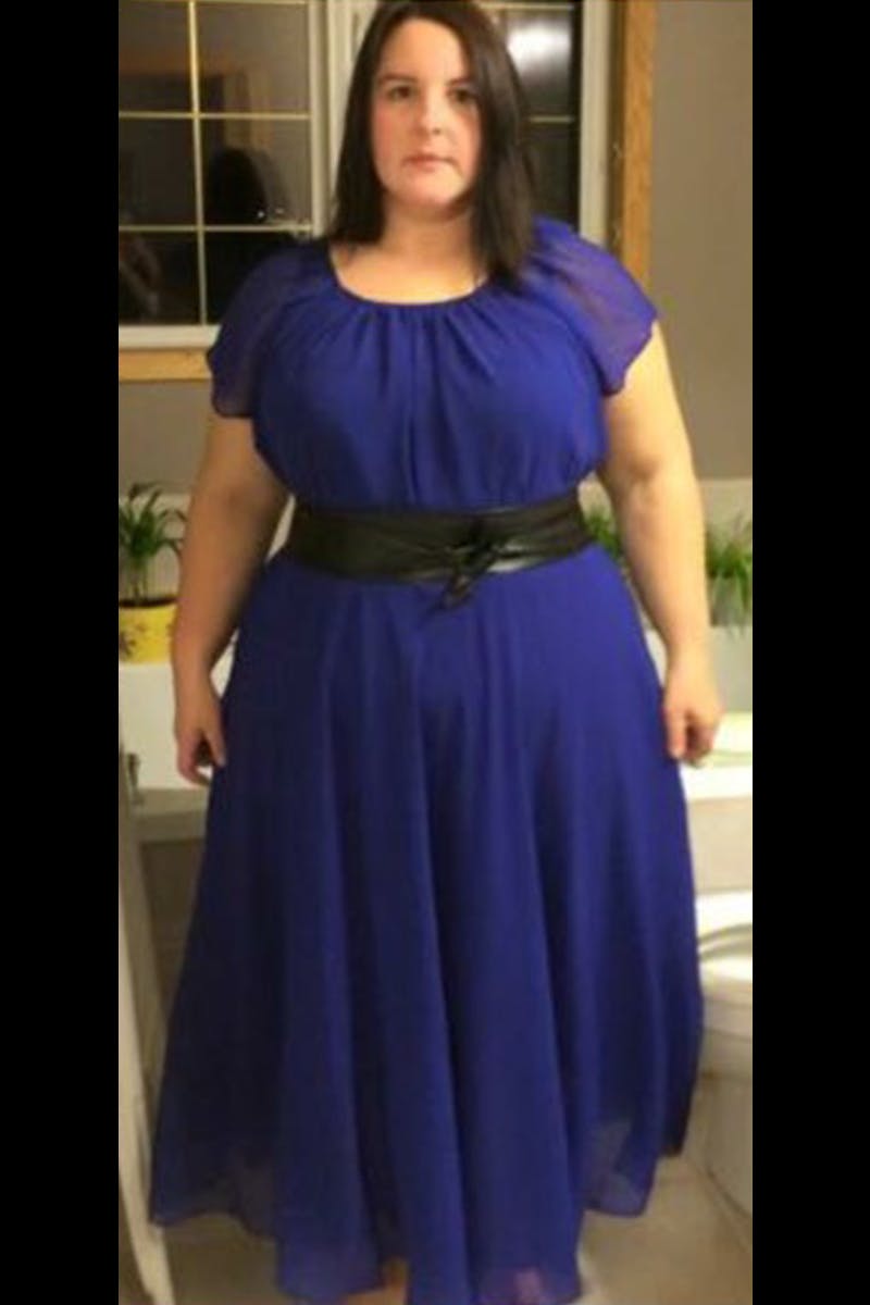 Patients 20-39 Years Old Before & After Gallery - Patient 14494353 - Image 1