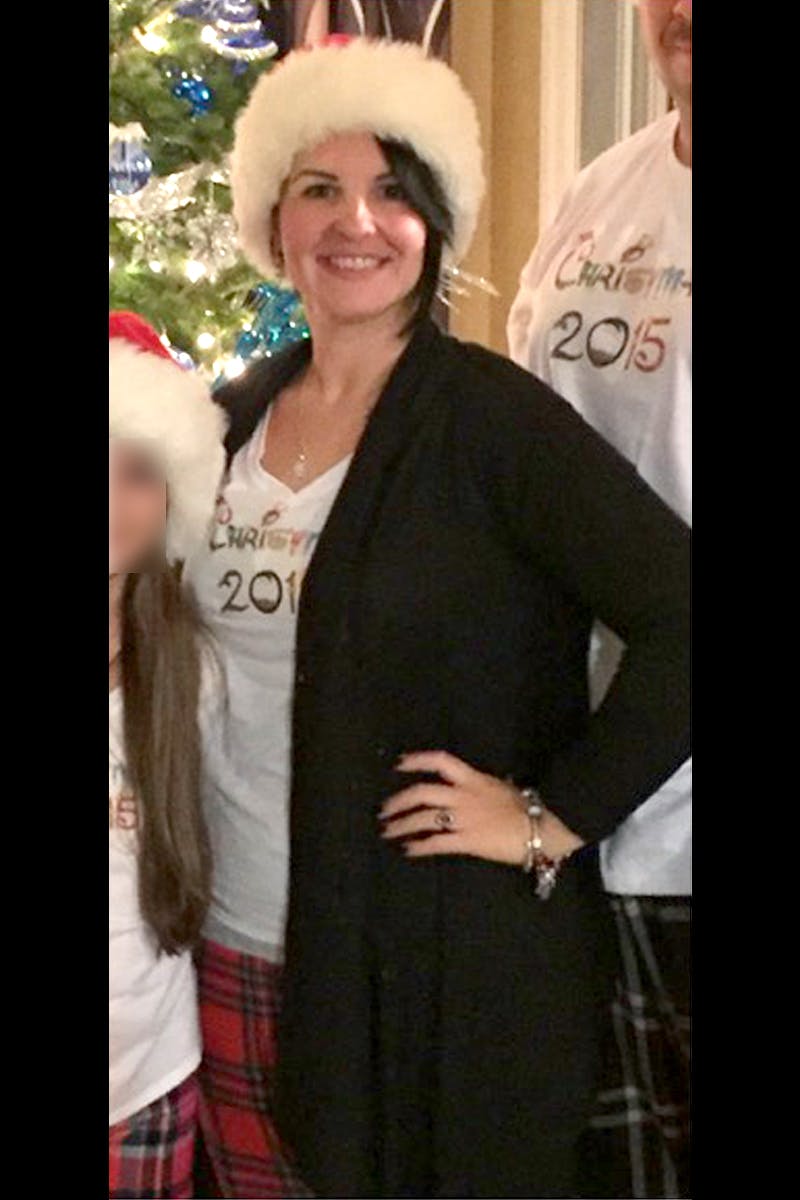 Patients 20-39 Years Old Before & After Gallery - Patient 14494353 - Image 2