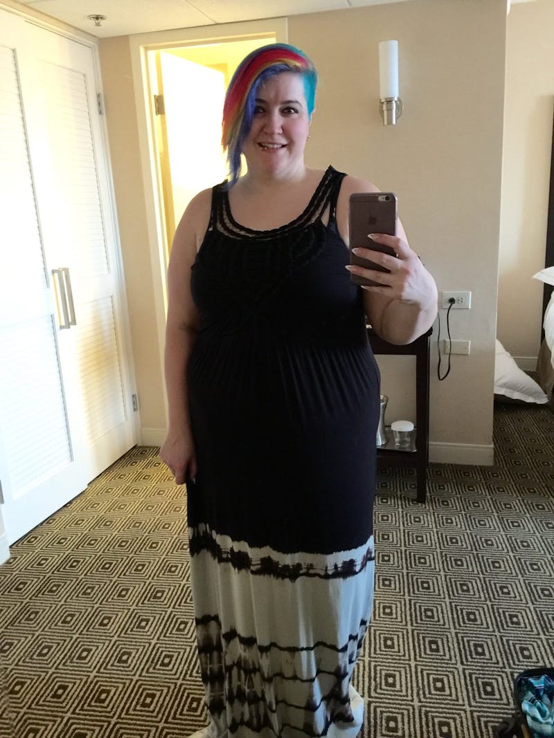 Patients 20-39 Years Old Before & After Gallery - Patient 14494354 - Image 1