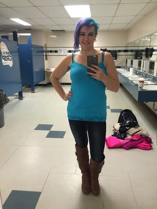 Patients 20-39 Years Old Before & After Gallery - Patient 14494354 - Image 2