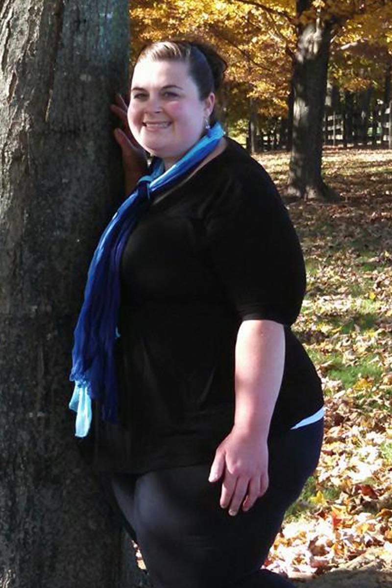 Patients 20-39 Years Old Before & After Gallery - Patient 14494355 - Image 1