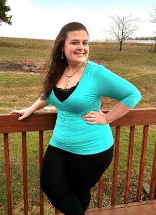 Patients 20-39 Years Old Before & After Gallery - Patient 14494355 - Image 2