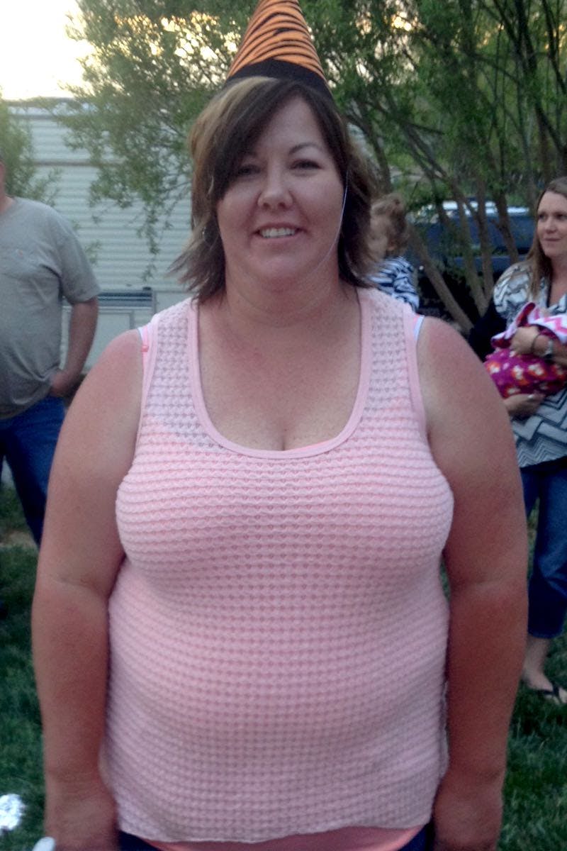 Patients 20-39 Years Old Before & After Gallery - Patient 14494356 - Image 1