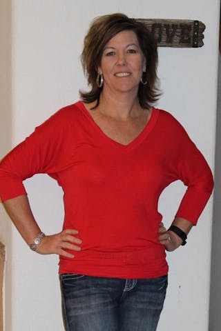 Patients 20-39 Years Old Before & After Gallery - Patient 14494356 - Image 2