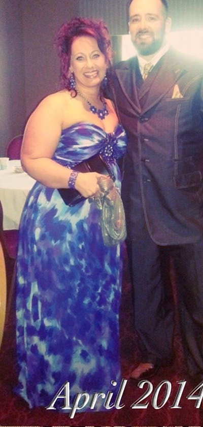 Patients 20-39 Years Old Before & After Gallery - Patient 14494359 - Image 1