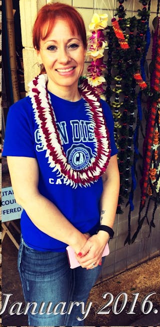 Patients 20-39 Years Old Before & After Gallery - Patient 14494359 - Image 2