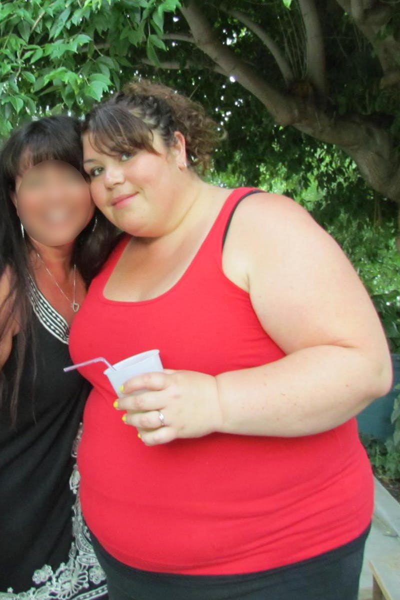 Patients 20-39 Years Old Before & After Gallery - Patient 14494360 - Image 1