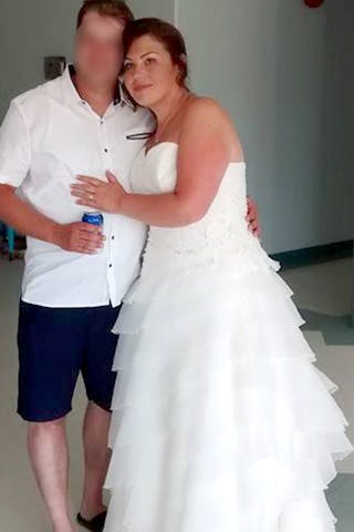 Patients 20-39 Years Old Before & After Gallery - Patient 14494360 - Image 2